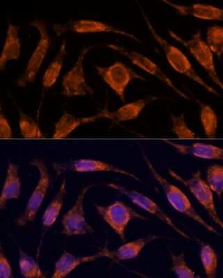 Immunocytochemistry/ Immunofluorescence: Importin4 Antibody - Azide and BSA Free [NBP3-03794]