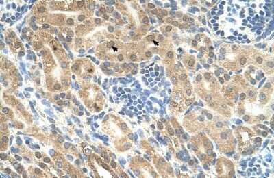 Immunohistochemistry-Paraffin: Indian Hedgehog/Ihh Antibody [NBP1-59443]