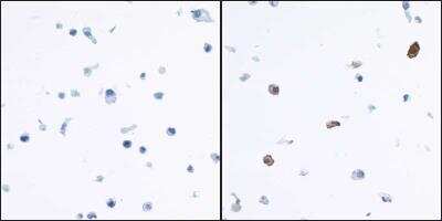 Immunocytochemistry/ Immunofluorescence: Indoleamine 2,3-dioxygenase/IDO Antibody (BLR031F) [NBP2-76404]