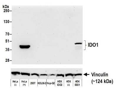 Western Blot: Indoleamine 2,3-dioxygenase/IDO Antibody (BLR031F) [NBP2-76404]