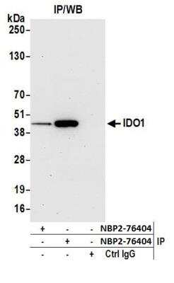 Western Blot: Indoleamine 2,3-dioxygenase/IDO Antibody (BLR040F) [NBP2-76408]