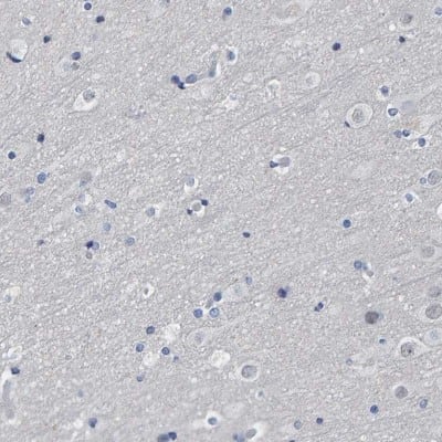 Immunohistochemistry-Paraffin: Indoleamine 2,3-dioxygenase/IDO Antibody [NBP1-87703]