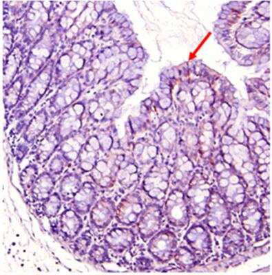 Immunohistochemistry-Paraffin: Indoleamine 2,3-dioxygenase/IDO Antibody [NBP2-80106]