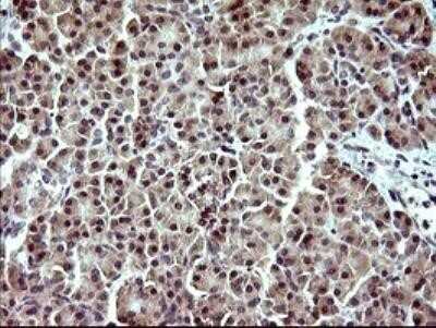 Immunohistochemistry: Indoleamine 2,3-dioxygenase/IDO Antibody (OTI2B5) - Azide and BSA Free [NBP2-71038]
