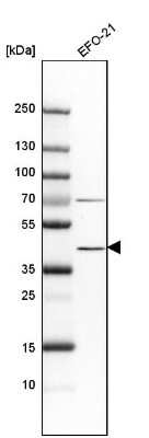 Western Blot: Indoleamine 2,3-dioxygenase/IDO Antibody [NBP1-87702]