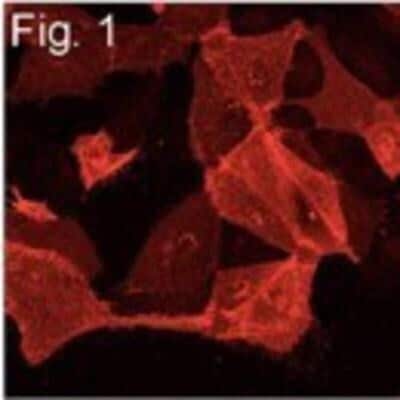 Immunocytochemistry/ Immunofluorescence: Influenza A H1N1 M2 Antibody (14C2) - (A/WSN/1933) [NB100-2073]