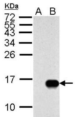 Western Blot: Influenza A H1N1 M2 Antibody(A/Puerto Rico/8/1934) [NBP2-14997]