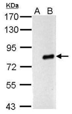 Western Blot: Influenza A H1N1 PA Antibody(A/Puerto Rico/8/1934) [NBP2-42876]