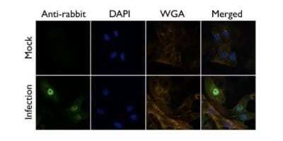 Immunocytochemistry/ Immunofluorescence: Influenza A H1N1 PB1 Antibody [NBP2-42877]