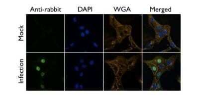 Immunocytochemistry/ Immunofluorescence: Influenza A H1N1 PB2 Antibody [NBP2-42878]