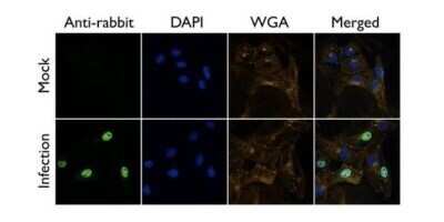 Immunocytochemistry/ Immunofluorescence: Influenza A H1N1 PB2 Antibody [NBP2-42879]