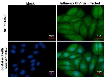 Immunocytochemistry/ Immunofluorescence: Influenza B nucleoprotein Antibody (GT382) - (B/Taiwan/753/2005) [NBP3-13500]