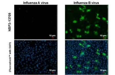 Immunocytochemistry/ Immunofluorescence: Influenza B nucleoprotein Antibody (HL1069) - (B/Taiwan/753/2005) [NBP3-13709]