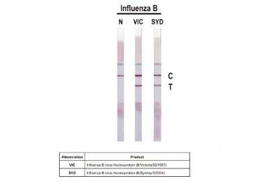 Lateral Flow Assay: Influenza B nucleoprotein Antibody (HL1069) - (B/Taiwan/753/2005) [NBP3-13709]