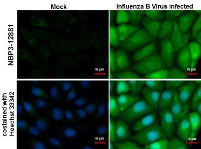 Immunocytochemistry/ Immunofluorescence: Influenza B nucleoprotein Antibody - (B/Taiwan/753/2005) [NBP3-12881]