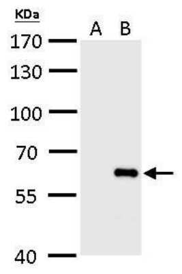 Western Blot: Influenza B nucleoprotein Antibody(B/Taiwan/753/2005) [NBP3-12881]