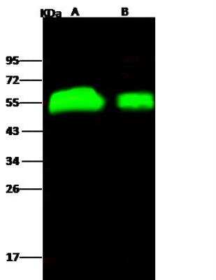 Western Blot: Influenza H4N6 Hemagglutinin Antibody [NBP3-12804]