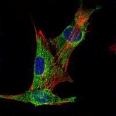 Immunocytochemistry/ Immunofluorescence: Inhibin alpha Antibody (4E2) - BSA Free [NBP1-51660]