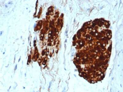Immunohistochemistry-Paraffin: Inhibin alpha Antibody (INHA/6598R) [NBP3-07460]