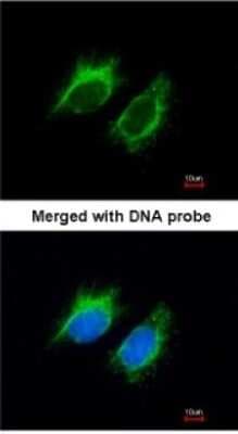 Immunocytochemistry/ Immunofluorescence: Activin A Antibody [NBP1-30928]