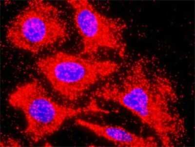 Proximity Ligation Assay: Activin B/Inhibin beta B Antibody [H00003625-D01P]