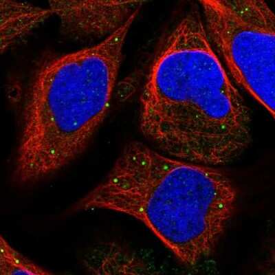 Immunocytochemistry/ Immunofluorescence: Inorganic Pyrophosphatase/PPA1 Antibody [NBP1-87787]
