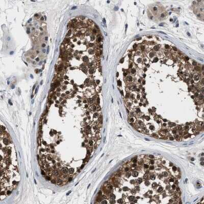Immunohistochemistry-Paraffin: Inorganic Pyrophosphatase/PPA1 Antibody [NBP1-87787]