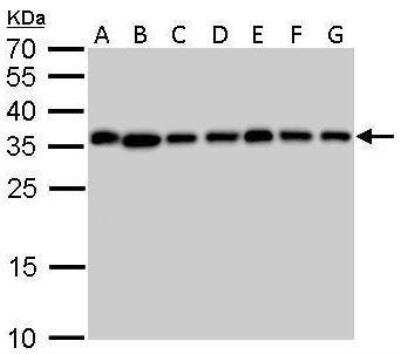 Western Blot: Inorganic Pyrophosphatase/PPA1 Antibody [NBP1-31348]