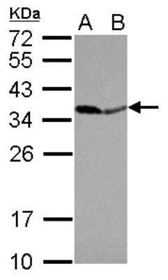 Western Blot: Inorganic Pyrophosphatase/PPA1 Antibody [NBP2-20021]