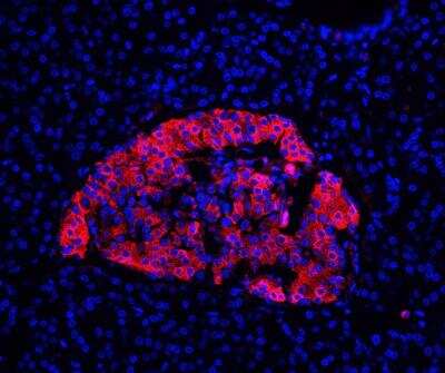 Immunohistochemistry-Paraffin: Insulin Antibody (E2-E3 + 2D11-H5 (same as INS04 + INS05)) [NBP2-34261]