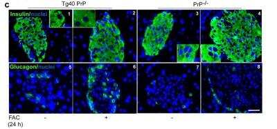 Immunohistochemistry: Insulin Antibody (E2-E3 (same as INS04)) [NBP2-34260]