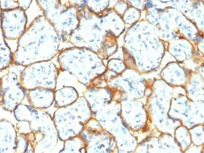 Immunohistochemistry-Paraffin: Insulin R/CD220 Antibody (INSR/2277R) - Azide and BSA Free [NBP3-08838]