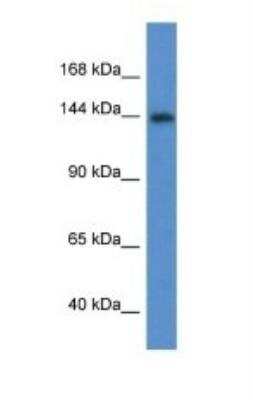 Western Blot: Insulin R/CD220 Antibody [NBP1-74140]