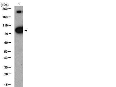 Immunoprecipitation: Insulin Receptor beta Antibody [NB120-10991]