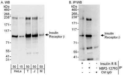 Immunoprecipitation: Insulin Receptor beta Antibody [NBP2-12793]