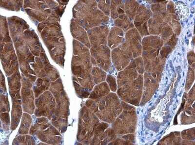 Immunohistochemistry-Paraffin: Insulysin/IDE Antibody (GT143) [NBP3-13560]
