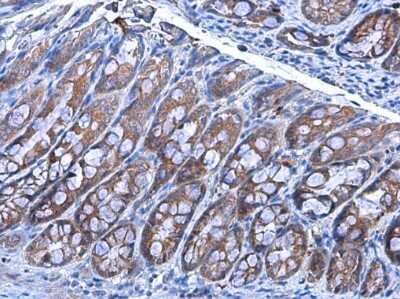 Immunohistochemistry-Paraffin: Insulysin/IDE Antibody (GT143) [NBP3-13560]