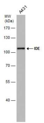 Western Blot: Insulysin/IDE Antibody (GT143) [NBP3-13560]