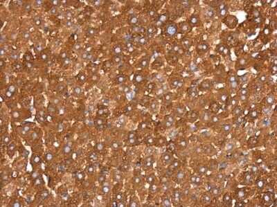 Immunohistochemistry-Paraffin: Insulysin/IDE Antibody (GT286) [NBP3-13547]