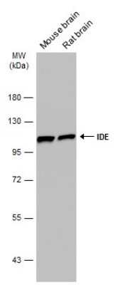 Western Blot: Insulysin/IDE Antibody (GT286) [NBP3-13547]