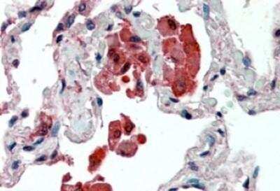 Immunohistochemistry-Paraffin: Insulysin/IDE Antibody [NB100-68148]