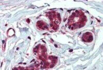 Immunohistochemistry-Paraffin: Insulysin/IDE Antibody [NB100-68148]