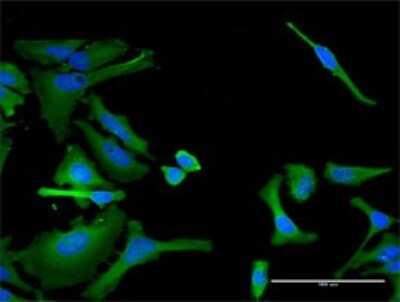 Immunocytochemistry/ Immunofluorescence: Integrin alpha 1/CD49a Antibody (4G11) [H00003672-M02]