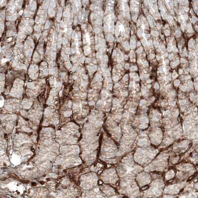 Immunohistochemistry-Paraffin: Integrin alpha 1/CD49a Antibody (CL7217) [NBP2-76479]