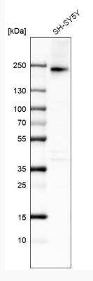 Western Blot: Integrin alpha 1/CD49a Antibody (CL7217) [NBP2-76479]