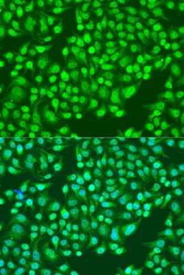 Immunocytochemistry/ Immunofluorescence: Integrin alpha 2/CD49b Antibody - Azide and BSA Free [NBP3-03851]