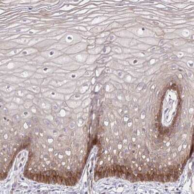 Immunohistochemistry-Paraffin: Integrin alpha 2/CD49b Antibody [NBP2-38902]