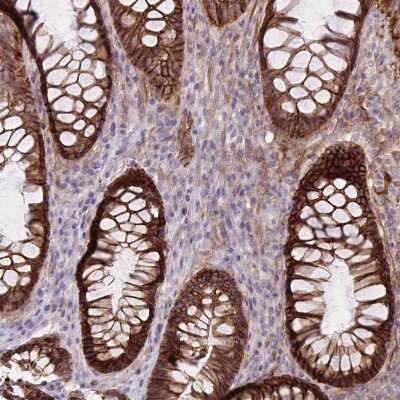 Immunohistochemistry-Paraffin: Integrin alpha 2/CD49b Antibody [NBP2-38995]