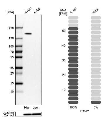 Western Blot: Integrin alpha 2/CD49b Antibody [NBP2-38995]