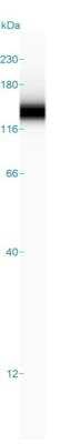 Simple Western: Integrin alpha 2b/CD41 Antibody [NBP1-84581]